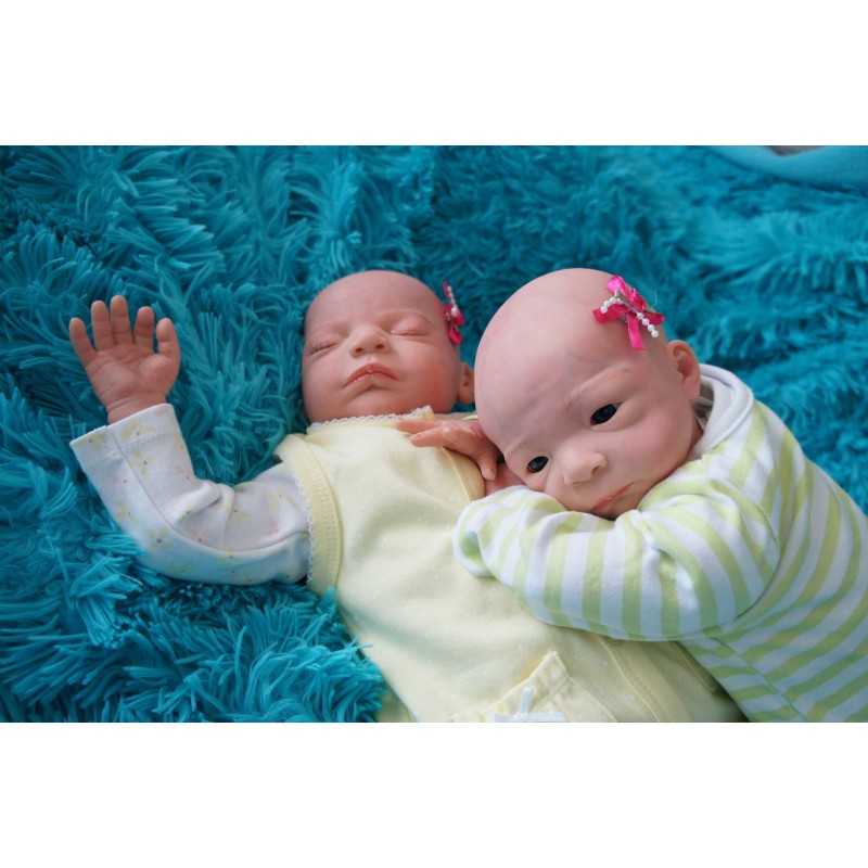 Nicola - Allergikerbaby - Glatzkop